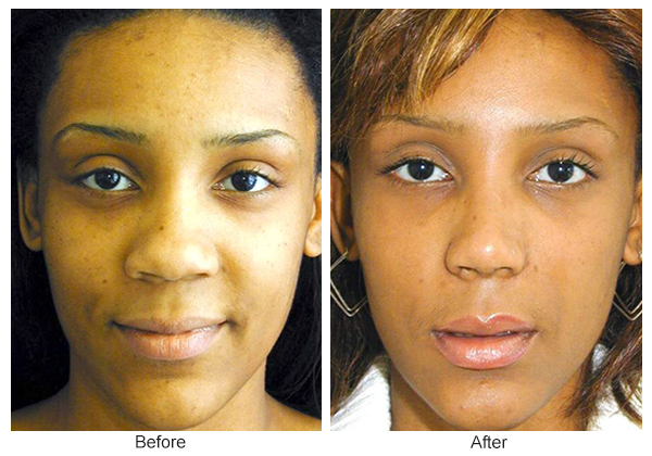 Hamilton Facial Plastic Surgery 104