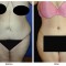 Orange County Cosmetic Surgery Clinique Before & After Body Lift 5 - Front