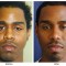 Orange County Cosmetic Surgery Clinique Before & After Rhinoplasty 13 - Front